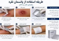 استفاده از نقره