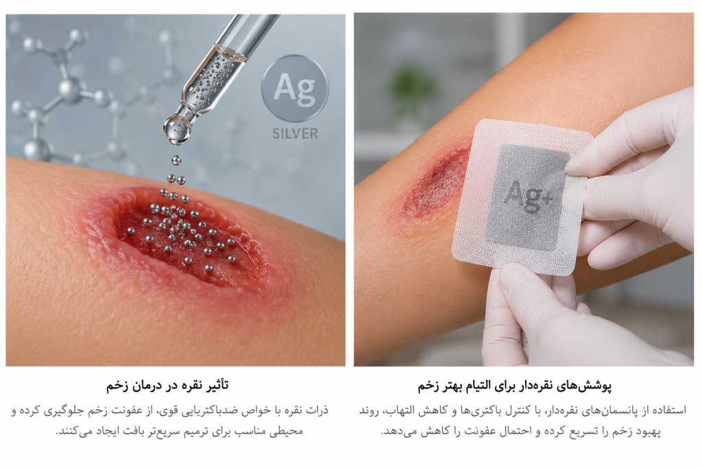 تاثیر نقره بر زخم