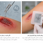 تاثیر نقره بر زخم