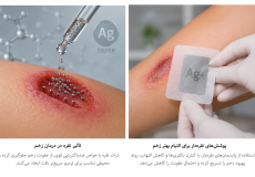 تاثیر نقره بر زخم