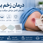 درمان زخم بستر