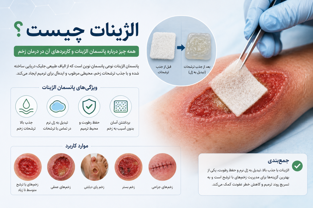 الژینات چیست