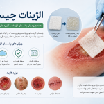 الژینات چیست