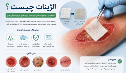 الژینات چیست